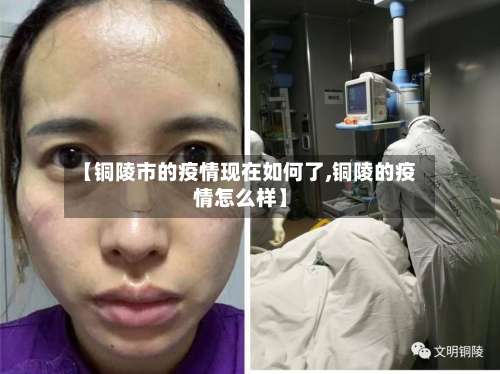 【铜陵市的疫情现在如何了,铜陵的疫情怎么样】-第1张图片