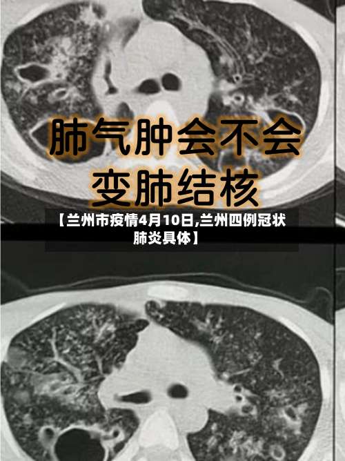 【兰州市疫情4月10日,兰州四例冠状肺炎具体】-第2张图片